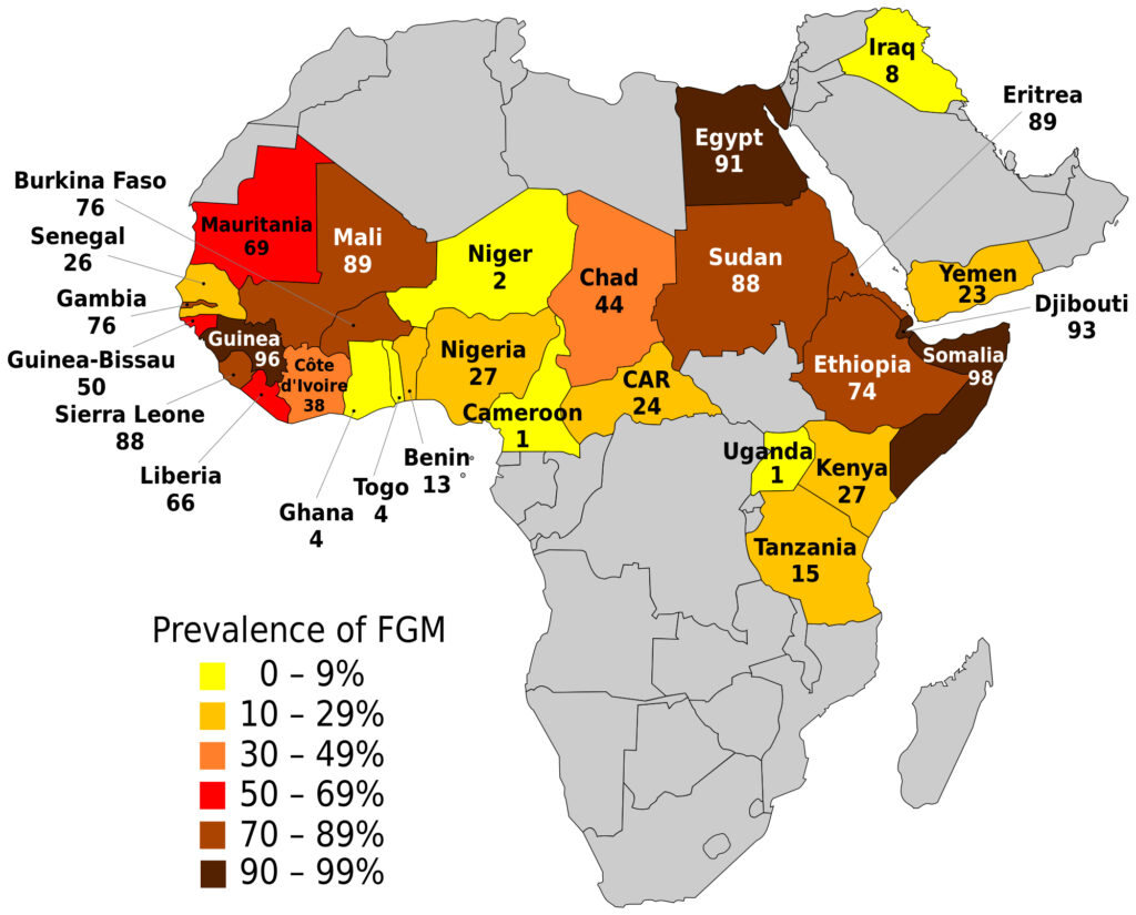 FGM – No place in Modern Society